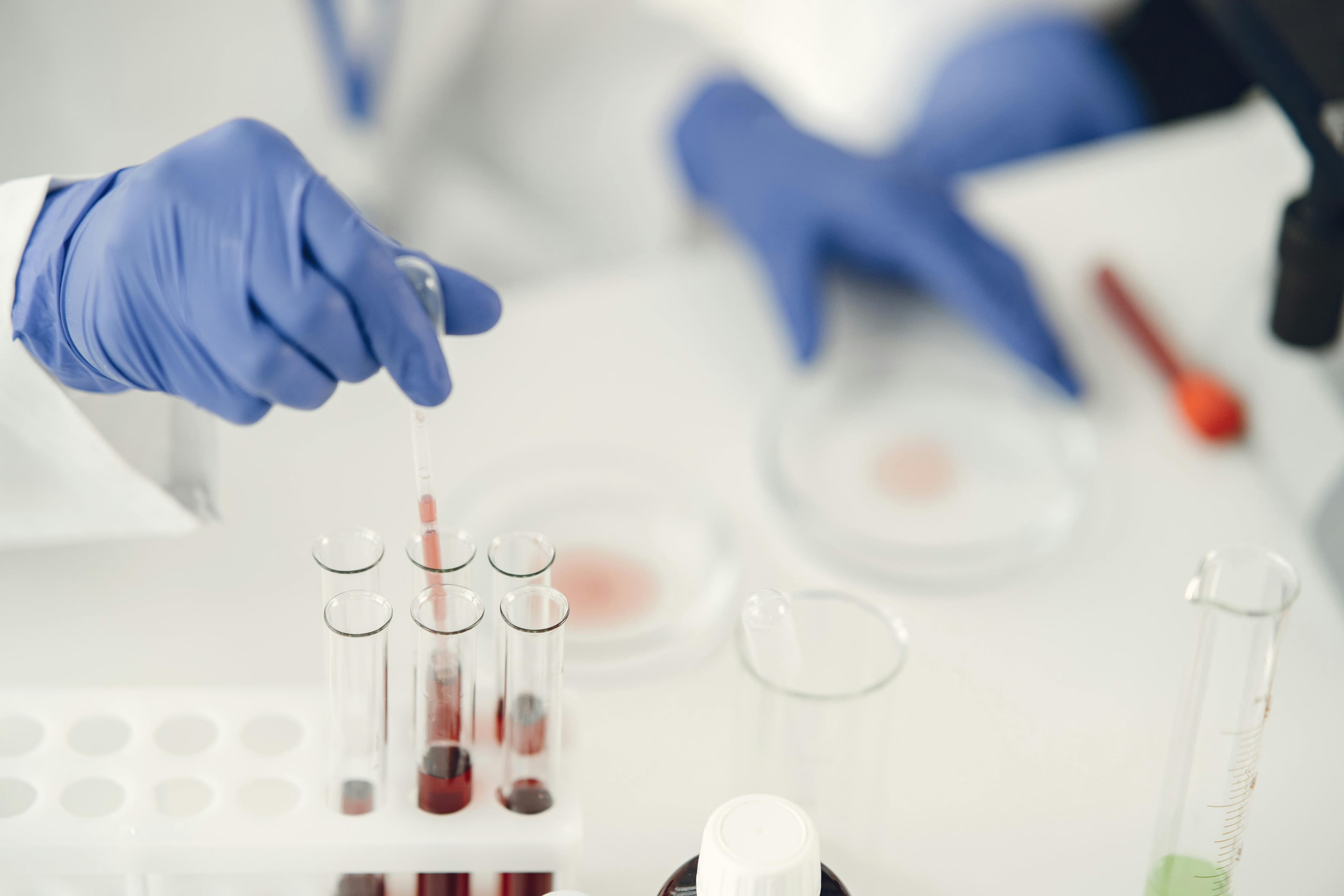 Laboratory sample materials and test tubes on a clinical bench during analysis.